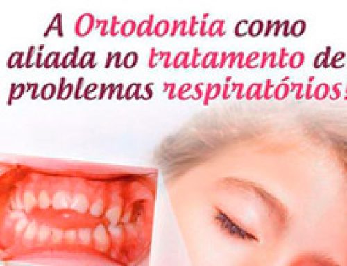A Ortodontia como aliada no tratamento de problemas respiratórios.
